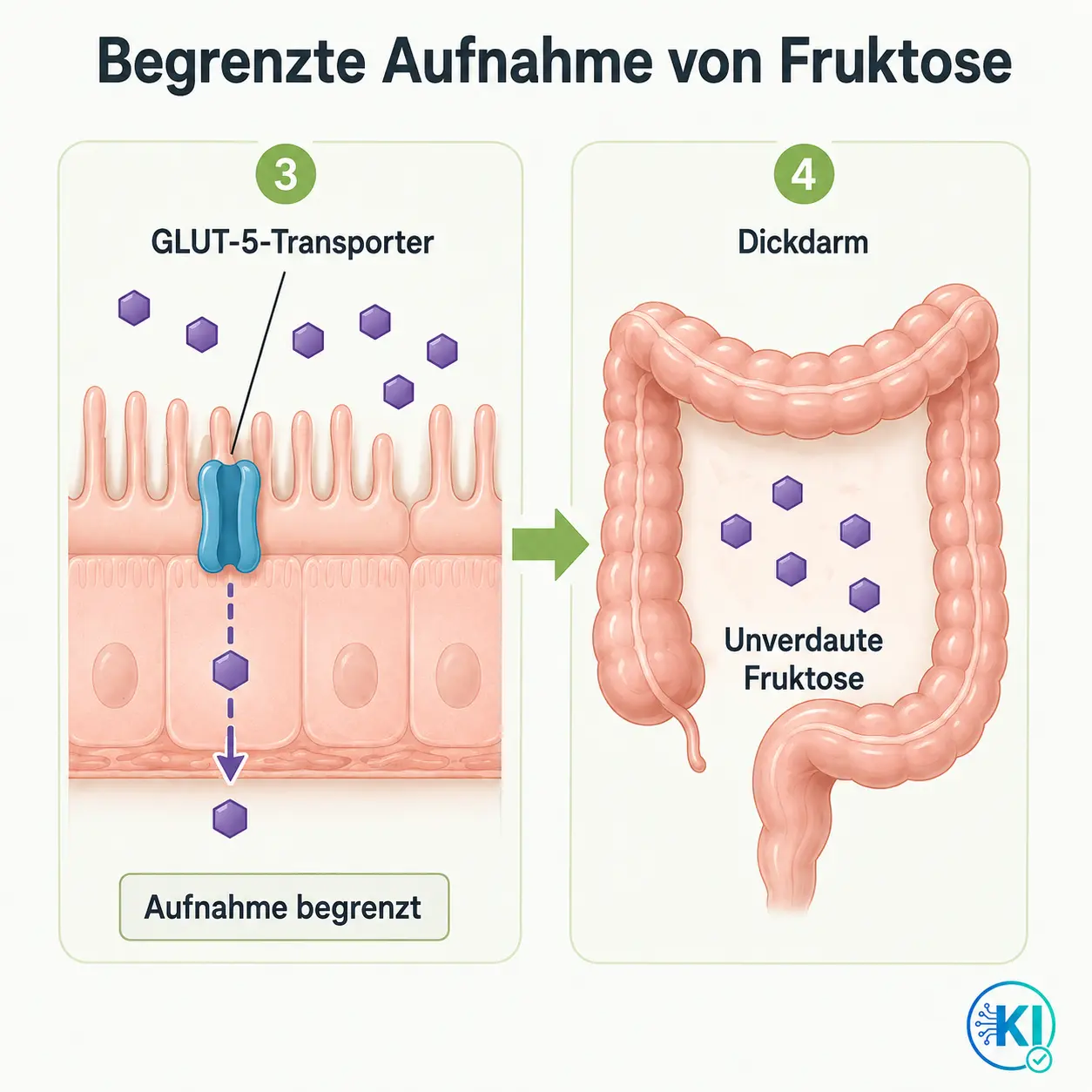 Fruktoseaufnahme und Dickdarm Die Darmbakterien fermentieren den Fruchtzucker, Wasser wird dazugegeben