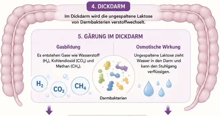 Laktoseintoleranz 1 wird die Laktose nicht ausreichend aufgespalten entstehen Blähungen und Durchfall