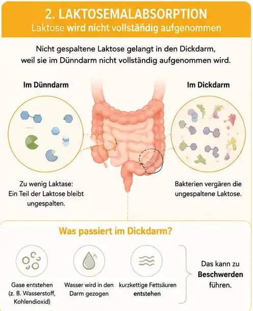 laktosemalabsorbtion Wenn zu wenig Laktase vorhanden ist - Malabsorbtion